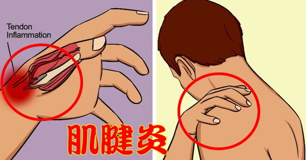 邵陽創(chuàng)傷骨科,邵陽風濕病區(qū),邵陽骨質(zhì)增生,邵陽關節(jié)病區(qū),邵陽頸椎病區(qū)