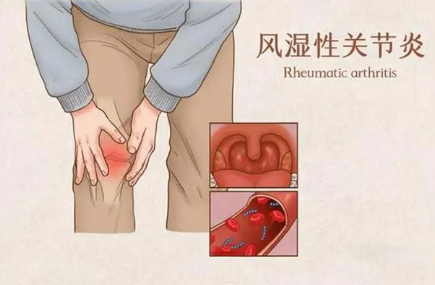 邵陽創(chuàng)傷骨科,邵陽風濕病區(qū),邵陽骨質(zhì)增生,邵陽關(guān)節(jié)病區(qū),邵陽頸椎病區(qū)