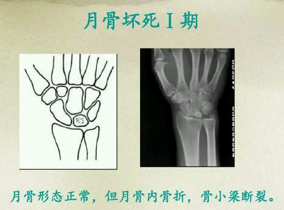 邵陽創(chuàng)傷骨科,邵陽風濕病區(qū),邵陽骨質(zhì)增生,邵陽關(guān)節(jié)病區(qū),邵陽頸椎病區(qū)